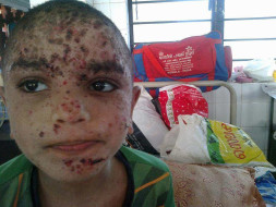 Help Thanseeh for Bone Marrow transplantation