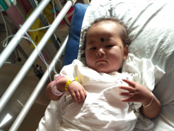 Liver transplant needed to save a child