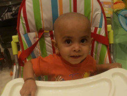 Help For Severe Thalassemia Operation For 1 Year- Old Child