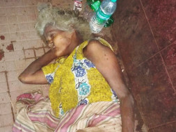 On Hospital's Death Bed With A Head Full Of Maggots, Please Save Her