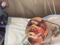 Help Darshan Recover From A Serious Accident