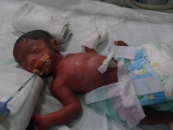 Mamathas Baby Was Born Extremely Premature At 26 Weeks. Please Support