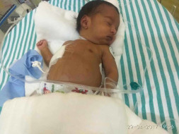 This Baby Developed Cancer A Week Before Her Birth