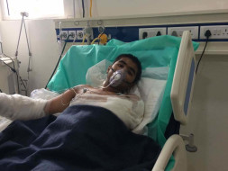 Help Cavin Recover From Burns & An Amputation Caused By Faulty Wiring