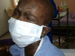 10 Years, 200 Transfusions, 1 Surgery & He Is Still Fighting To Live