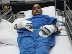 Help My Brother For His Surgery