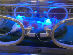 This New-Born Is Fighting Infections And Need Your Help To Stay Alive