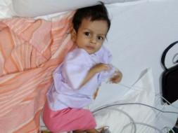 Open heart surgery for 4 months old Baby Girl Shraddha