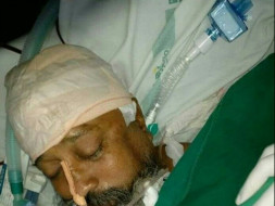 My father Mr. Paramjeet Singh met an accident few days ago.