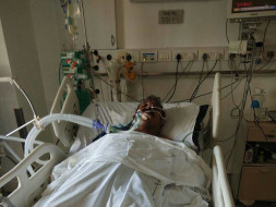 Brain Surgery for Blood Clots