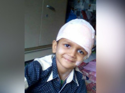 Help Durva Undergo A Crucial Brain Surgery