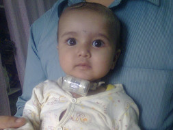 'Help Jathin fighting with major breathing problem'