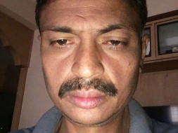 Help 44-Year-Old Man Undergo Liver Transplant