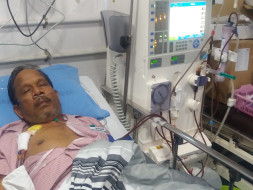 Help My Husband Undergo plasma Transplant, both kidneys failed