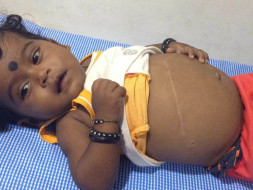 Help this 7-month-old undergo a liver transplant