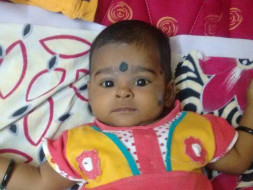Help Baby Ridhi Undergo A Liver Transplant