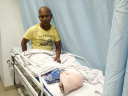 Cancer Has Made My Bones So Fragile That Even Walking Can Break My Leg