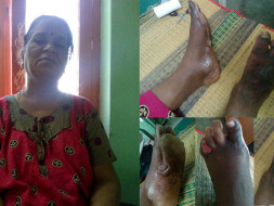 Help My Mother and make her to walk again