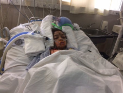 A Brain Tumor Has Left 10-year-old Shraboni As A Breathing Corpse.