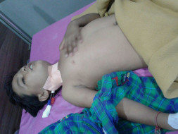 My Child Krishna Hitesh Dhamecha Is A Thalassemia major Patient