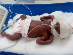 Help Ganesh To Save His 26-Week-Old Son