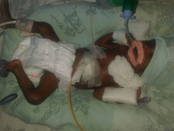 SAVE THIS PREMATURE BABY