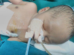 Baby Of Nazia Needs Your Help To Live