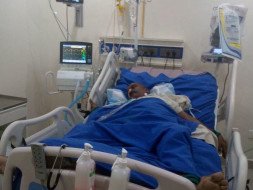 Help My Father Brain Surgery(Decompressive craniotomy for stroke )