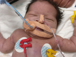 Baby of Reshma need our Help