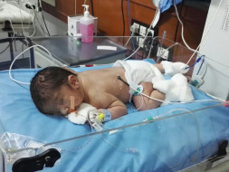 Help Baby Avyaan fight Pierre Robin Syndrome