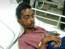 Need Money For A Friend's Skull fracture Operation