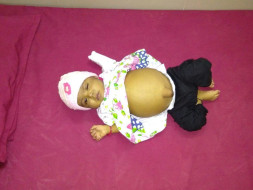 Help Baby Tahoora Begum Undergo A Liver Transplant