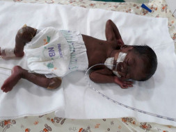 Help Twins of Amudha Get Ventilator Support