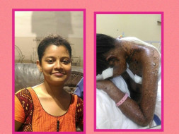 Help priyanka in fighting skin disease steven johnson syndrome
