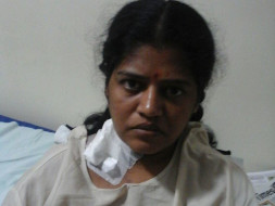 Help Nirmala Fight Cancer By Undergoing Bone Marrow Transplant