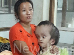 Little boy’s head swells to size of watermelon - Help Boisang