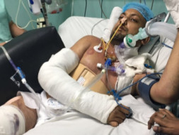 Help Kumar Anand To Fight Against A Severe Brain Injury