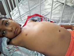 Help Little boy Nandhan Undergo A Liver Transplante