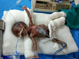 My Baby Weights 470 Grams And I Need Your Help To Save Her