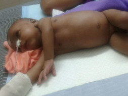 Save Little 2-Month's Old Baby From Hirschsprung Disease