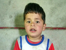 Help Uzair Javid To Undergo Treatment