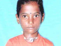 Help Sangeetha to recover from Severe Grade IV Subglotic Stenosis