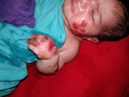 My 10-day Old daughter Is Suffering From A Skin Condition Please Help.