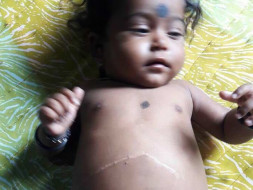 Let's save 9 months old baby Mahonnathi from a serious liver condition