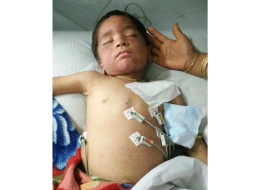 Help 3 year-old Gautam Fight Blood Cancer!