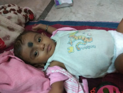 Born Preterm, Timely Treatment Can Still Save 6-month-old Baby Ganesh