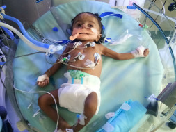 Nellore School Teacher Struggles To Save 5-Month-Old Daughter’s Life