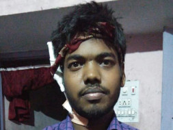 Help Our Friend Ashish To Get A Kidney Transplant