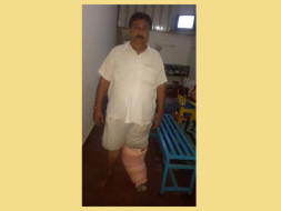 Help Chetan To Recover From Elephant Leg Disease