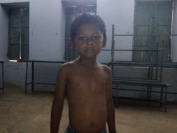 Help 5-year-old-Annamalai undergo heart surgery